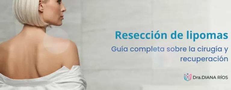 reseccion-lipomas-medellin-guia-sobre-cirugia